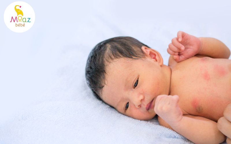 Tắm cho trẻ bằng các loại lá làm mát cơ thể, giảm ngứa da Tắm cho trẻ bằng các loại lá làm mát cơ thể, giảm ngứa da