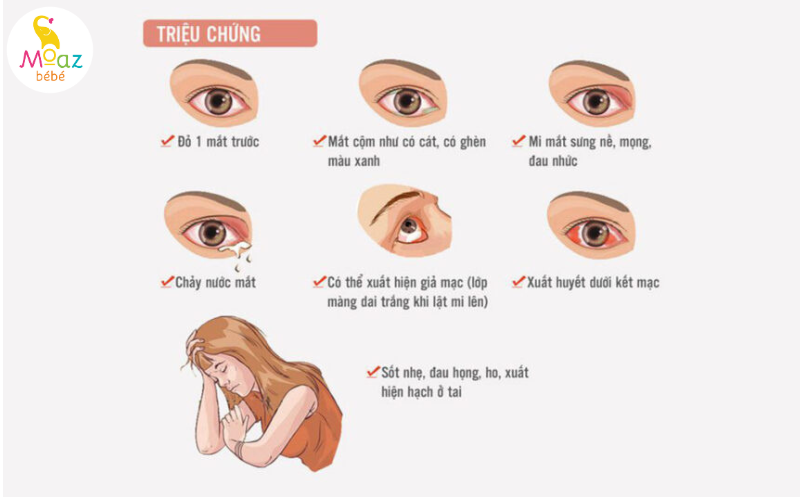 Các triệu chứng khi bị bệnh đau mắt đỏ