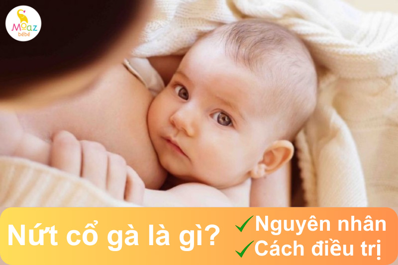 Nứt cổ gà có nguy hiểm không?