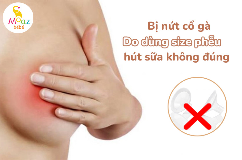 nứt cổ gà do dùng máy hút sữa không đúng size