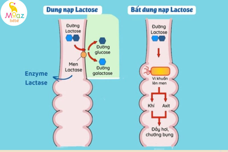 bất dung nạp lactose là gì