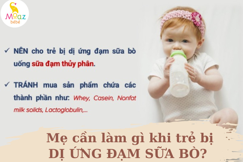 Mẹ cần làm gì khi trẻ bị dị ứng đạm sữa bò