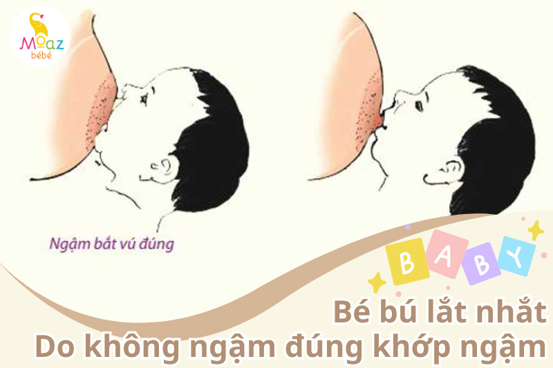 bú lắt nhắt do bé bú sai tư thế và không ngậm đúng khớp ngậm