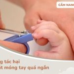 cắt móng tay và móng chân quá ngắn có thể gây ra nhiều tác hại khó kiểm soát