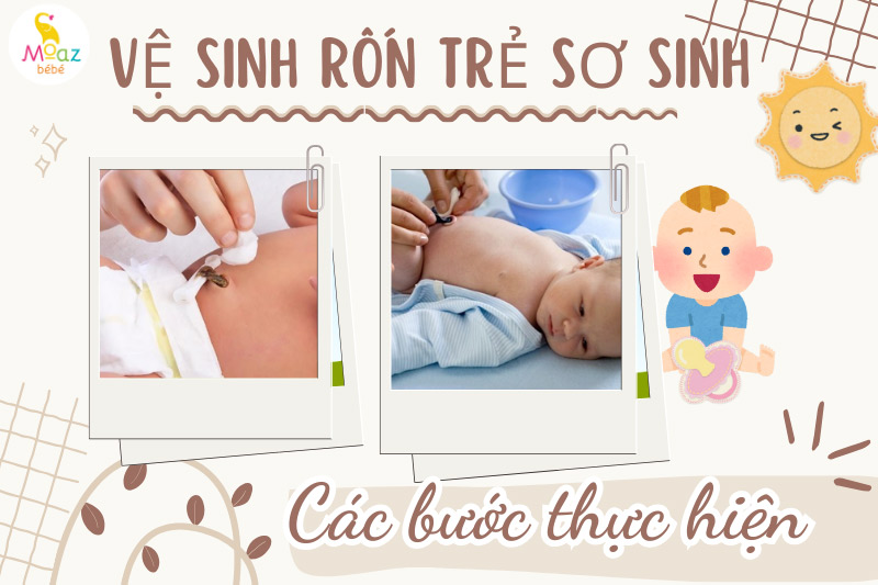 Các bước vệ sinh rốn cho trẻ sơ sinh tại nhà