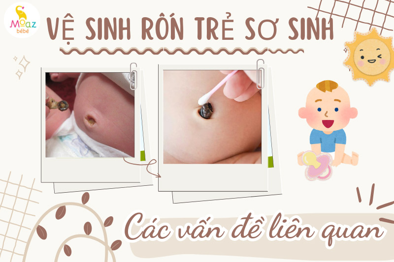 Các vấn đề liên quan đến việc vệ sinh rốn của trẻ sơ sinh