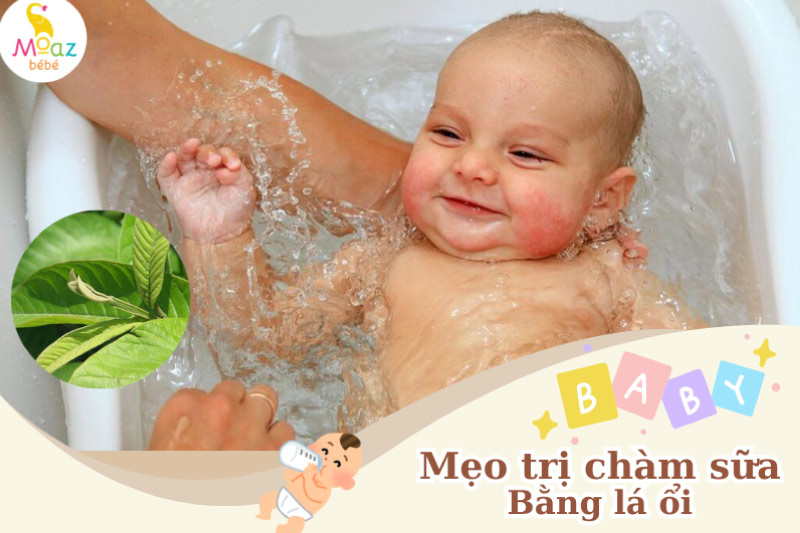 Mẹo dân gian chữa chàm sữa ở trẻ sơ sinh