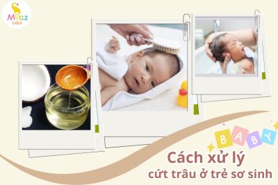 mẹo trị cứt trâu ở trẻ sơ sinh