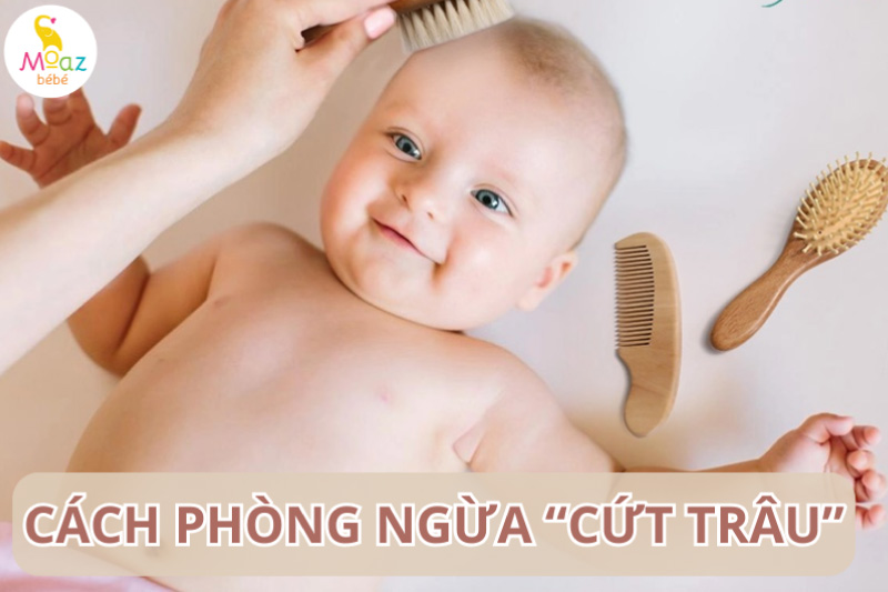 cách phòng ngừa cứt trâu ở trẻ sơ sinh