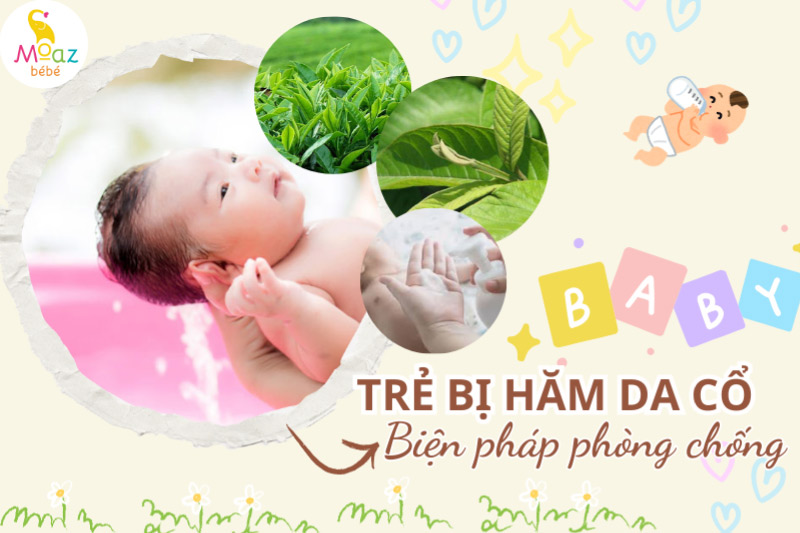 Các biện pháp phòng tránh hăm cổ ở trẻ sơ sinh