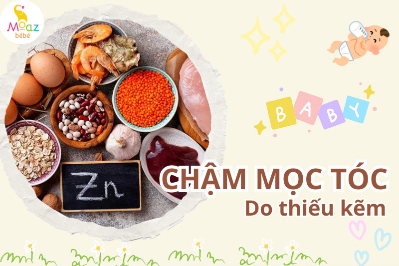 Trẻ chậm mọc tóc thiếu chất gì? 