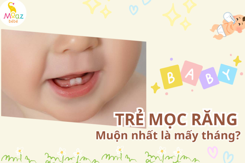 Trẻ mọc răng muộn nhất là mấy tháng?