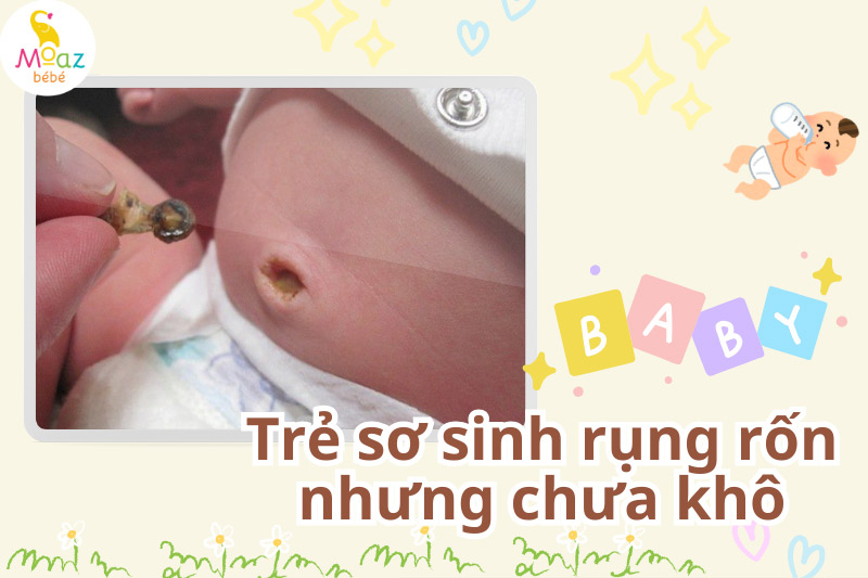 Sau khi rụng rốn bao lâu thì khô?