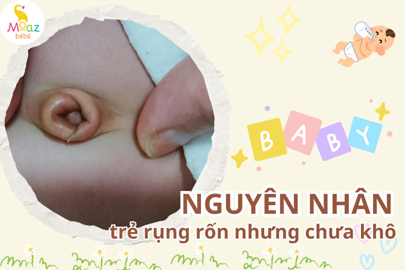 Nguyên nhân trẻ sơ sinh rụng rốn nhưng chưa khô