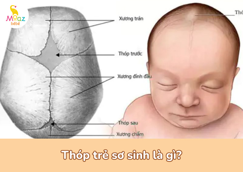 Thóp trẻ sơ sinh là gì?