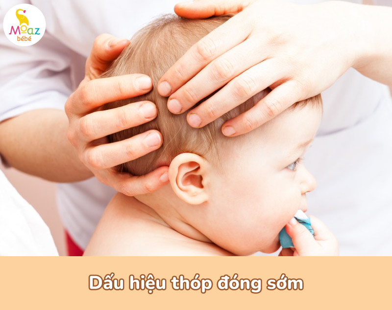 Dấu hiệu thóp đóng sớm