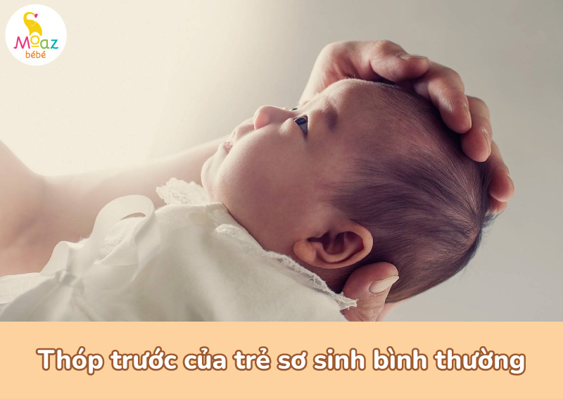 Thóp trước của trẻ sơ sinh bình thường