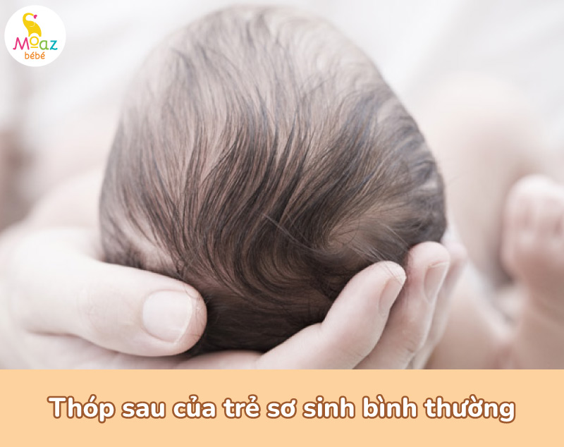 Thóp sau của trẻ sơ sinh bình thường