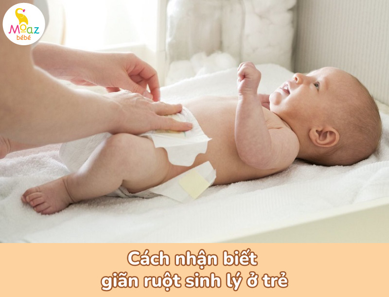 Cách nhận biết giãn ruột sinh lý ở trẻ