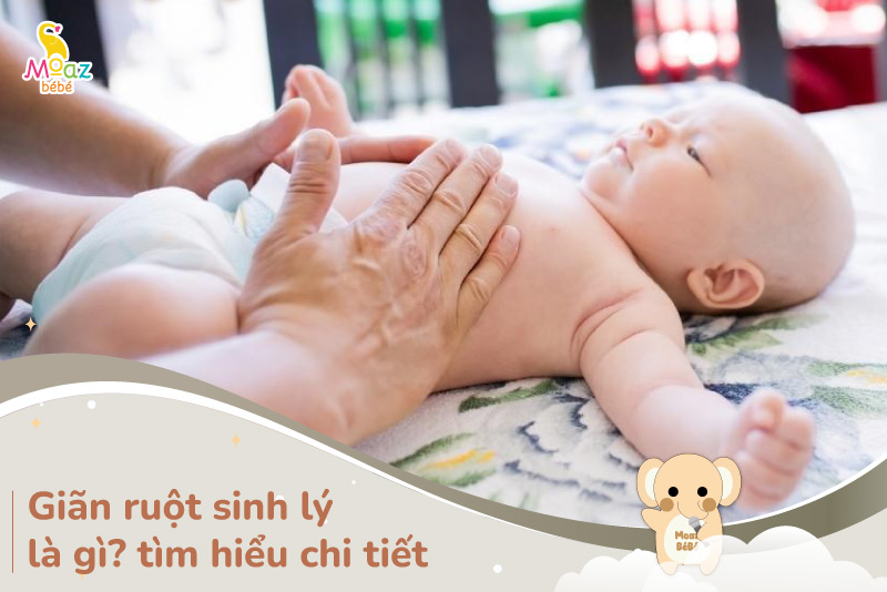 Giãn ruột sinh lý ở trẻ sơ sinh là gì?