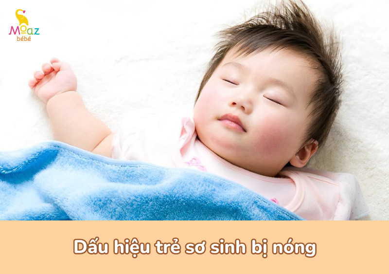 Dấu hiệu trẻ sơ sinh bị nóng