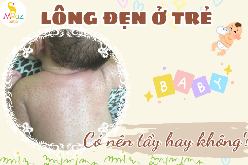 Có nên tẩy lông đẹn cho trẻ hay không? 