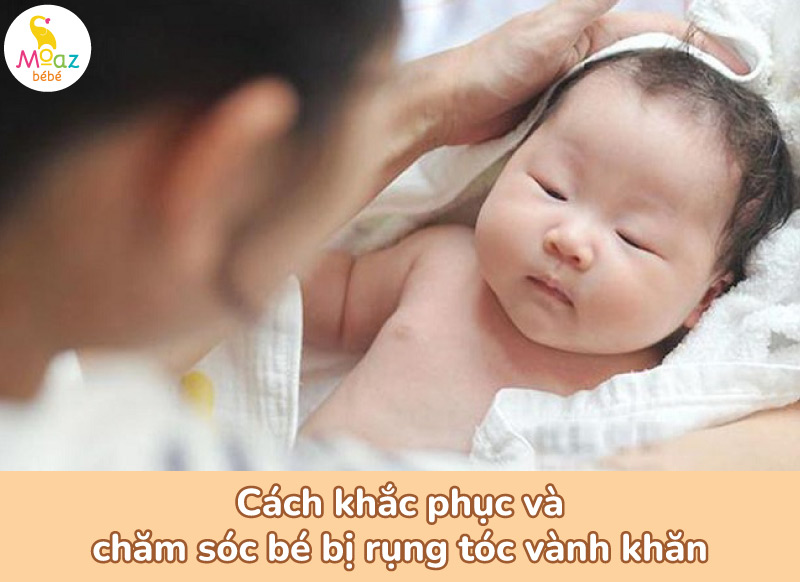 Cách khắc phục và chăm sóc trẻ bị rụng tóc vành khăn