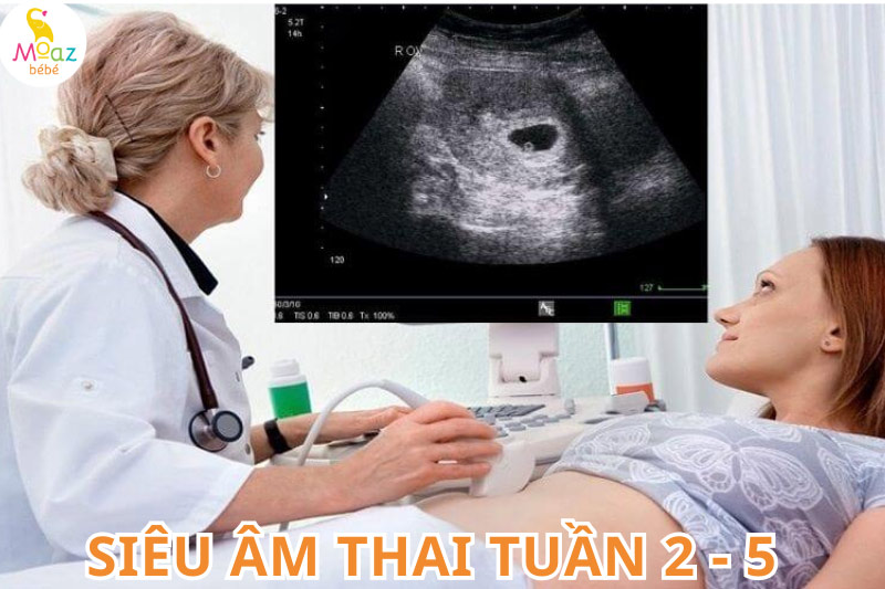 Thai 2 – 5 tuần siêu âm có thấy mặt bé không?