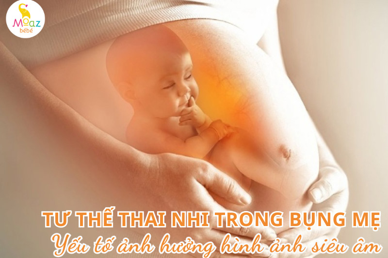 Nguyên nhân không thấy rõ mặt thai nhi khi siêu âm