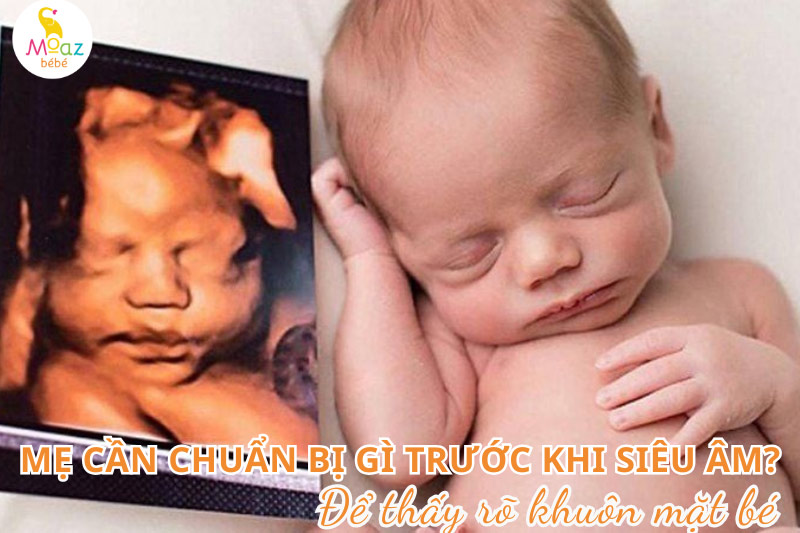 Mẹ bầu cần chuẩn bị gì trước khi siêu âm để thấy rõ mặt bé