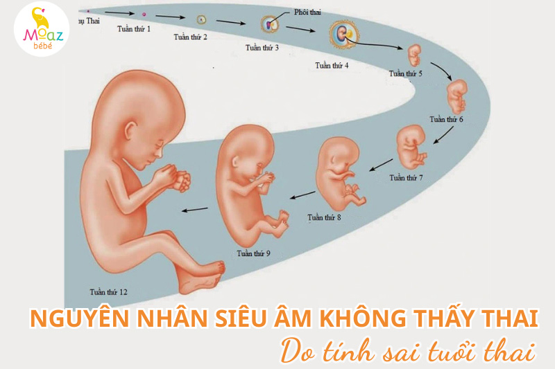 Nguyên nhân siêu âm không thấy thai dù trễ kinh 20 ngày