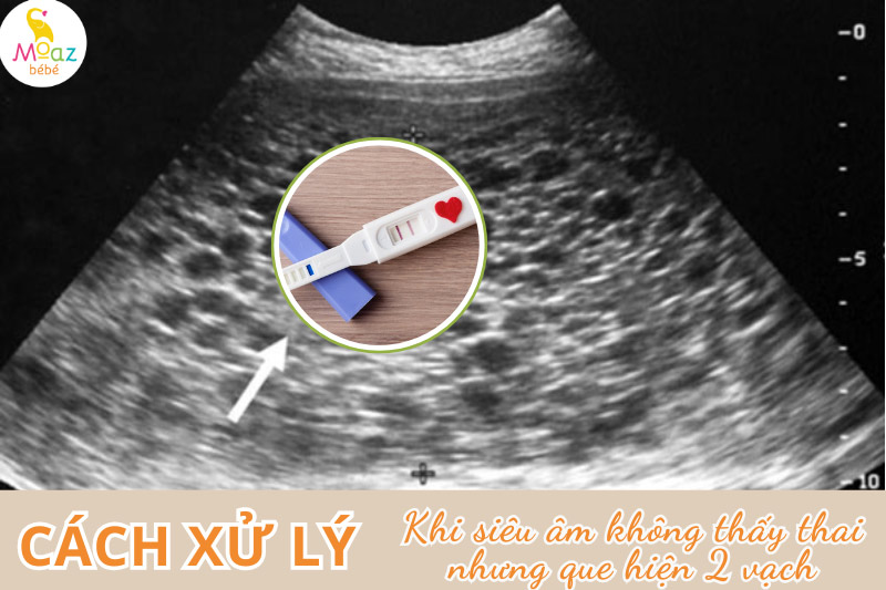 Cách xử lý khi siêu âm không thấy thai nhưng que thử 2 vạch