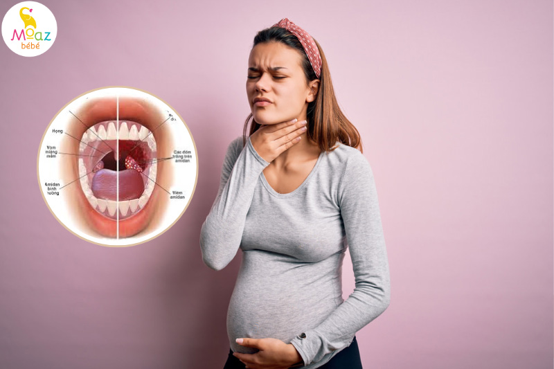 Tìm hiểu viêm họng là gì?