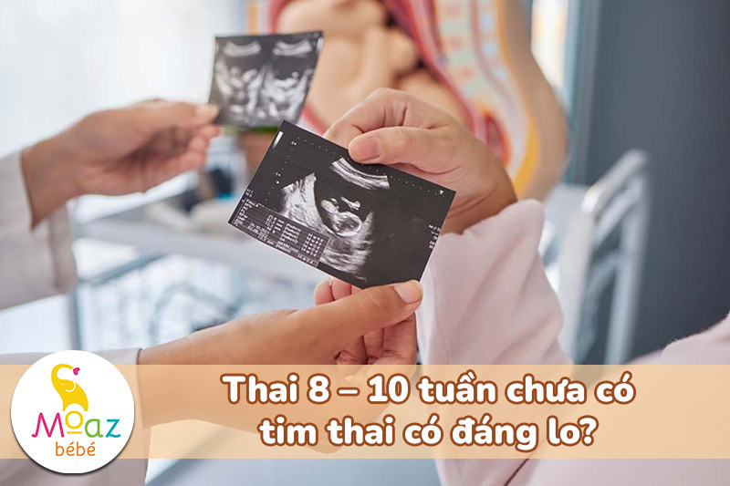 Thai 8 – 10 tuần chưa có tim thai có đáng lo?
