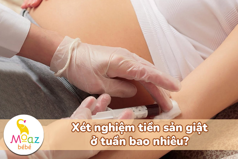Xét nghiệm tiền sản giật ở tuần bao nhiêu?