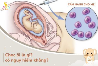 Tìm hiểu chọc ối là gì?