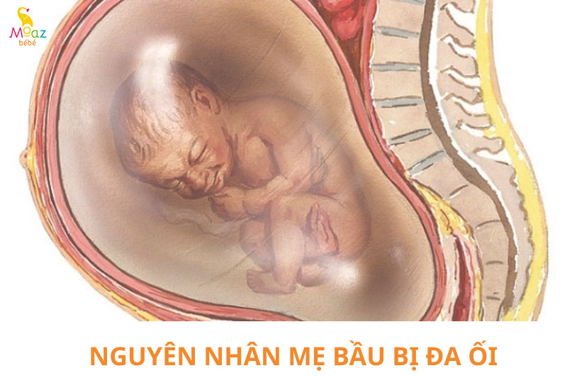 Nguyên nhân mẹ bầu bị đa ối