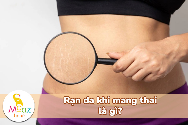 Tìm hiểu rạn da là gì?
