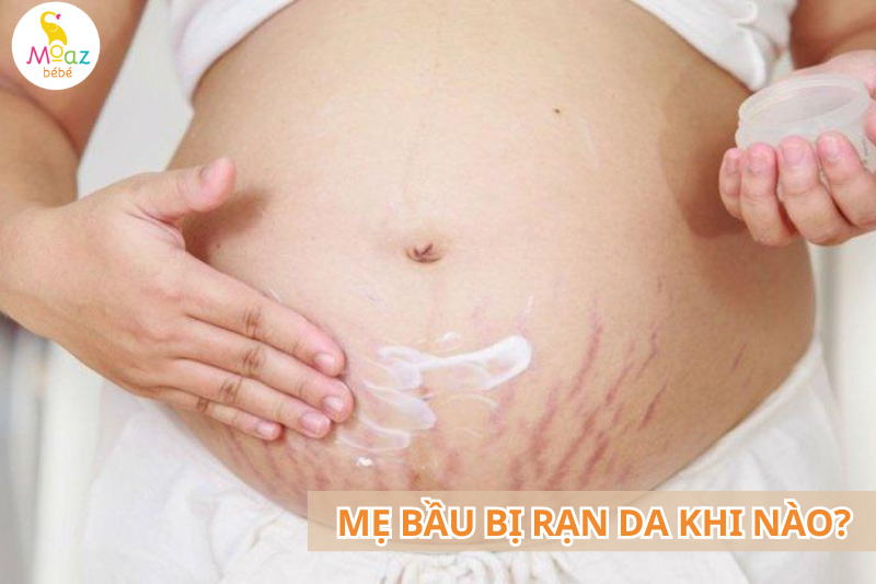 Mẹ bầu bị rạn da khi nào?