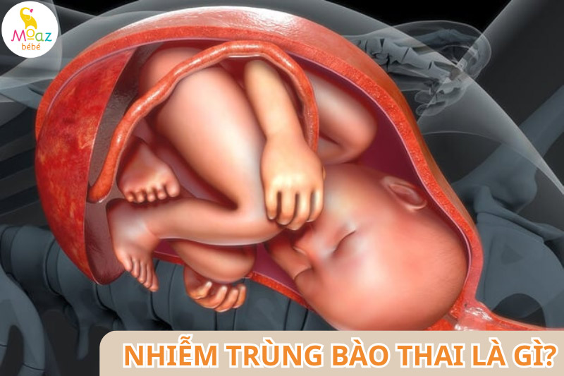 Nhiễm trùng bào thai là gì?