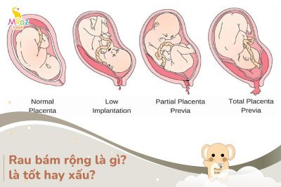 Rau bám rộng là gì?