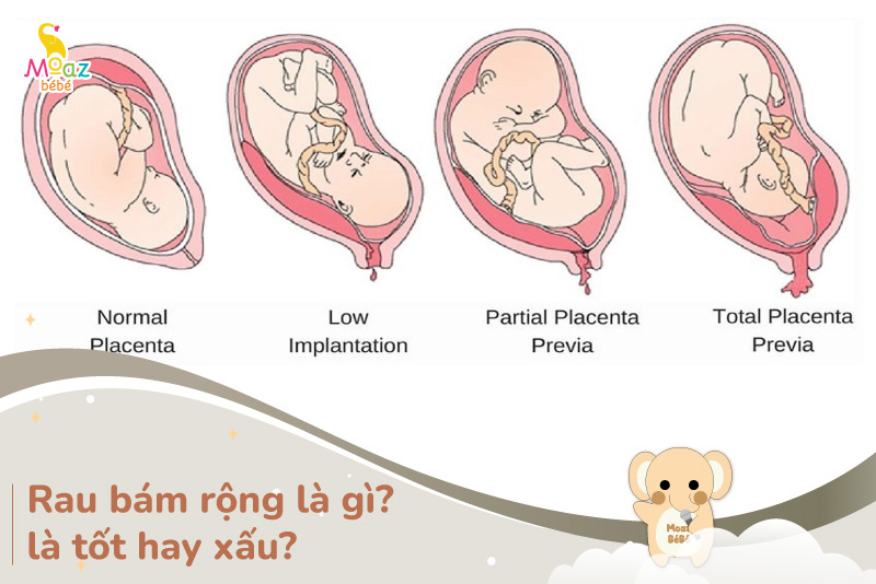 Rau bám rộng là gì?