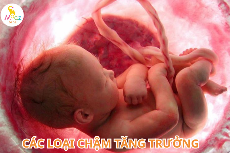 Các loại chậm tăng trưởng của thai