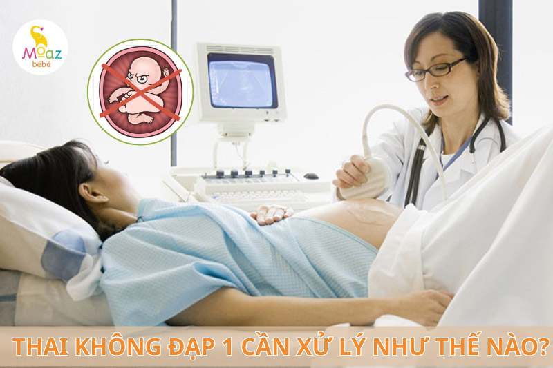 Hiện tượng thai không đạp cần xử lý như thế nào?