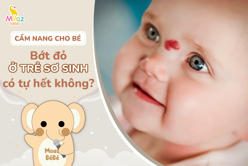 Bớt đỏ của trẻ sơ sinh có tự hết không