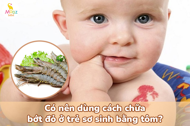 Có nên dùng cách chữa bớt đỏ ở trẻ sơ sinh bằng tôm?