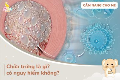 Chửa trứng là gì?