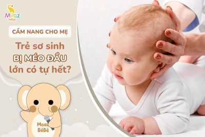 Trẻ sơ sinh bị méo đầu lớn có hết không?