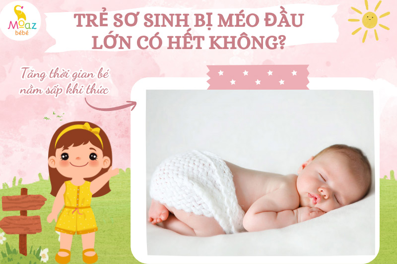 trẻ sơ sinh bị méo đầu bố mẹ phải làm sao?