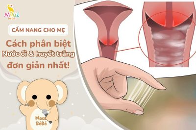 Cách nhận biết nước ối và huyết trắng đơn giản nhất